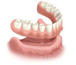 tooth replacement dentist Lafayette and Boulder