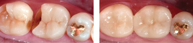 Before and after E4D