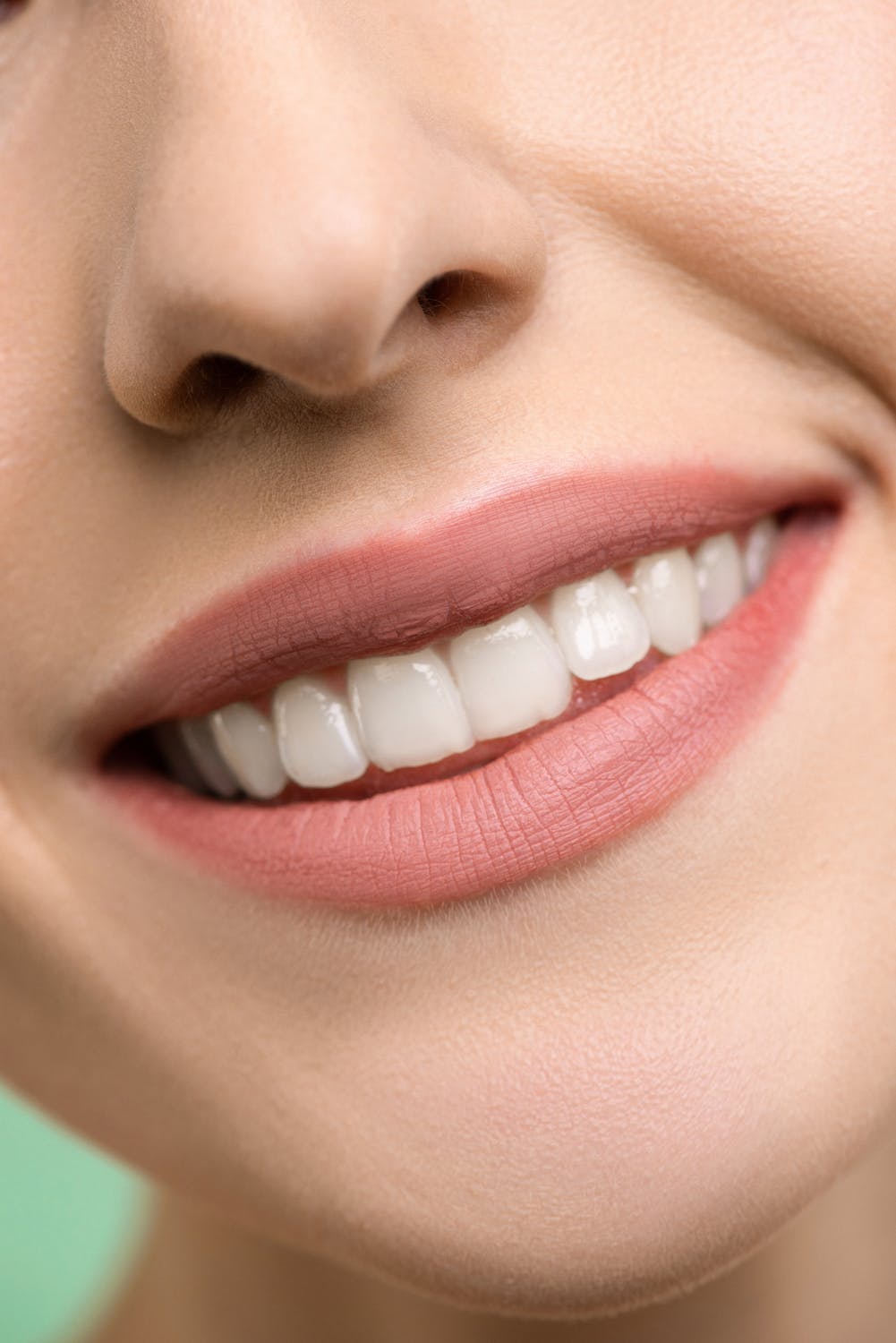 Lafayette Tooth Whitening For Whiter Smiles