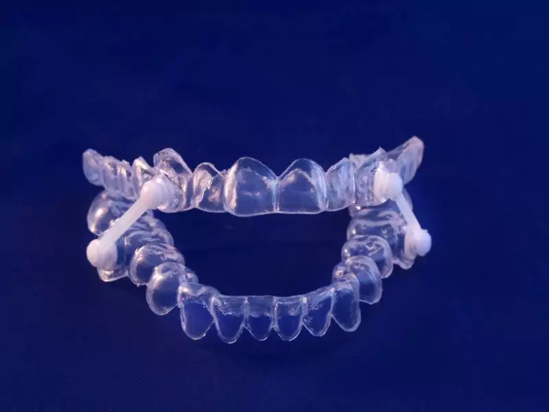Sleep apnea appliance