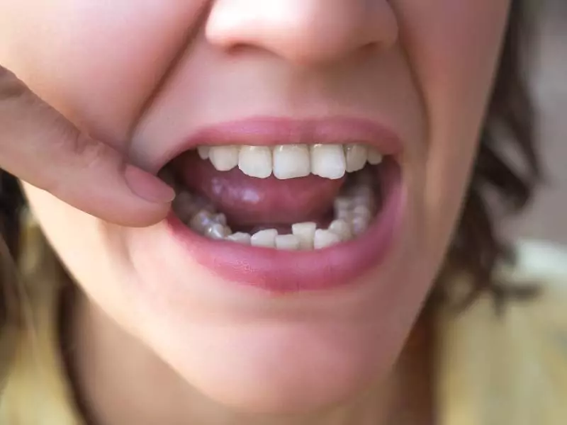 Woman with crooked teeth