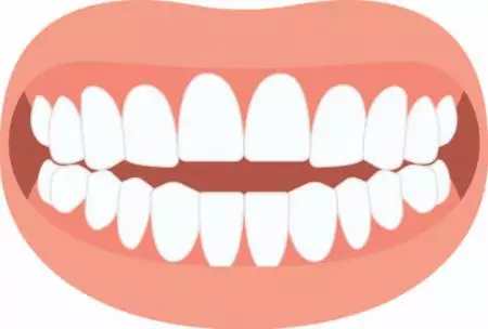 Open bite graphic